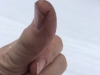 Day 8 Skin wears down with temps - exposure - slower healing